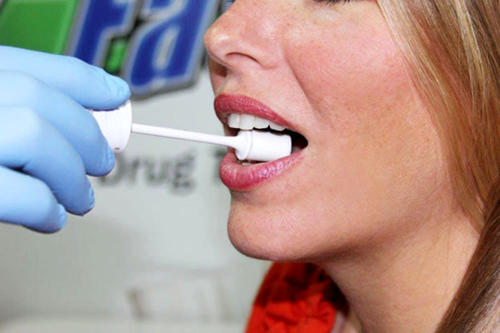 Кислоты полости рта. Сбор слюны. Исследование слюны в стоматологии.