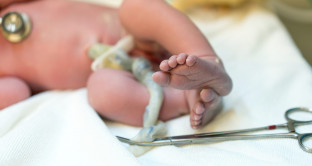 Ha suscitato scalpore il caso della coppia di Udine che si rifiutava di far tagliare il cordone ombelicale alla figlia neonata.