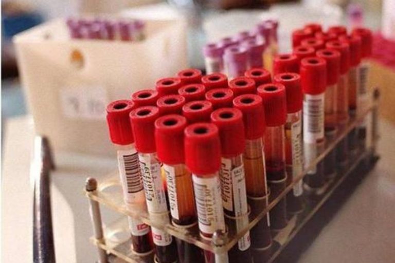 I dipendenti che donano sangue, anche se inidonei, hanno diritto alla retribuzione e il datore può chiederne rimborso all’INPS